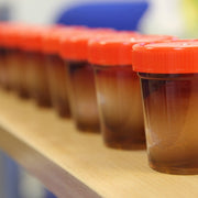 Sample Containers — Laboratory Container