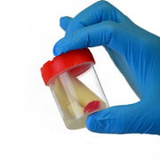 Sample Containers — Laboratory Container
